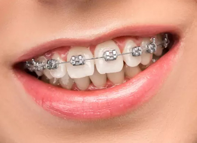 Orthodontics