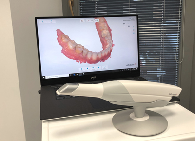 intraoral-scanner